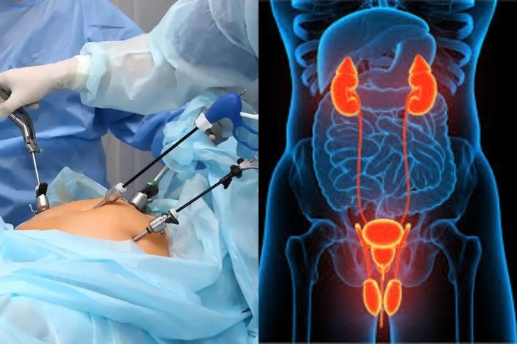 laproscopic surgery urology guntur